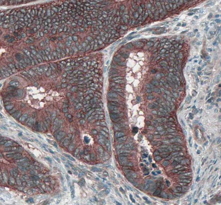 Mouse HGFR/c-MET Antibody AF527