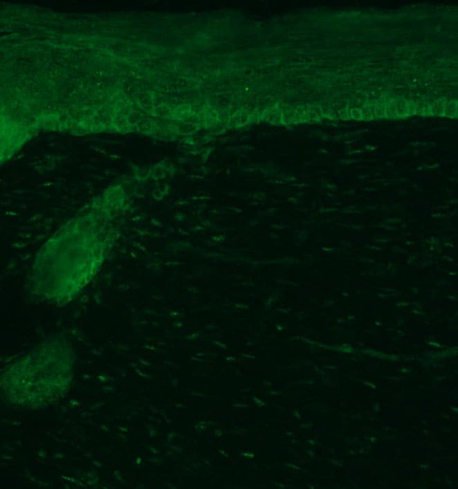 Human/Mouse/Rat PEDFR/PNPLA2 Antibody AF5365
