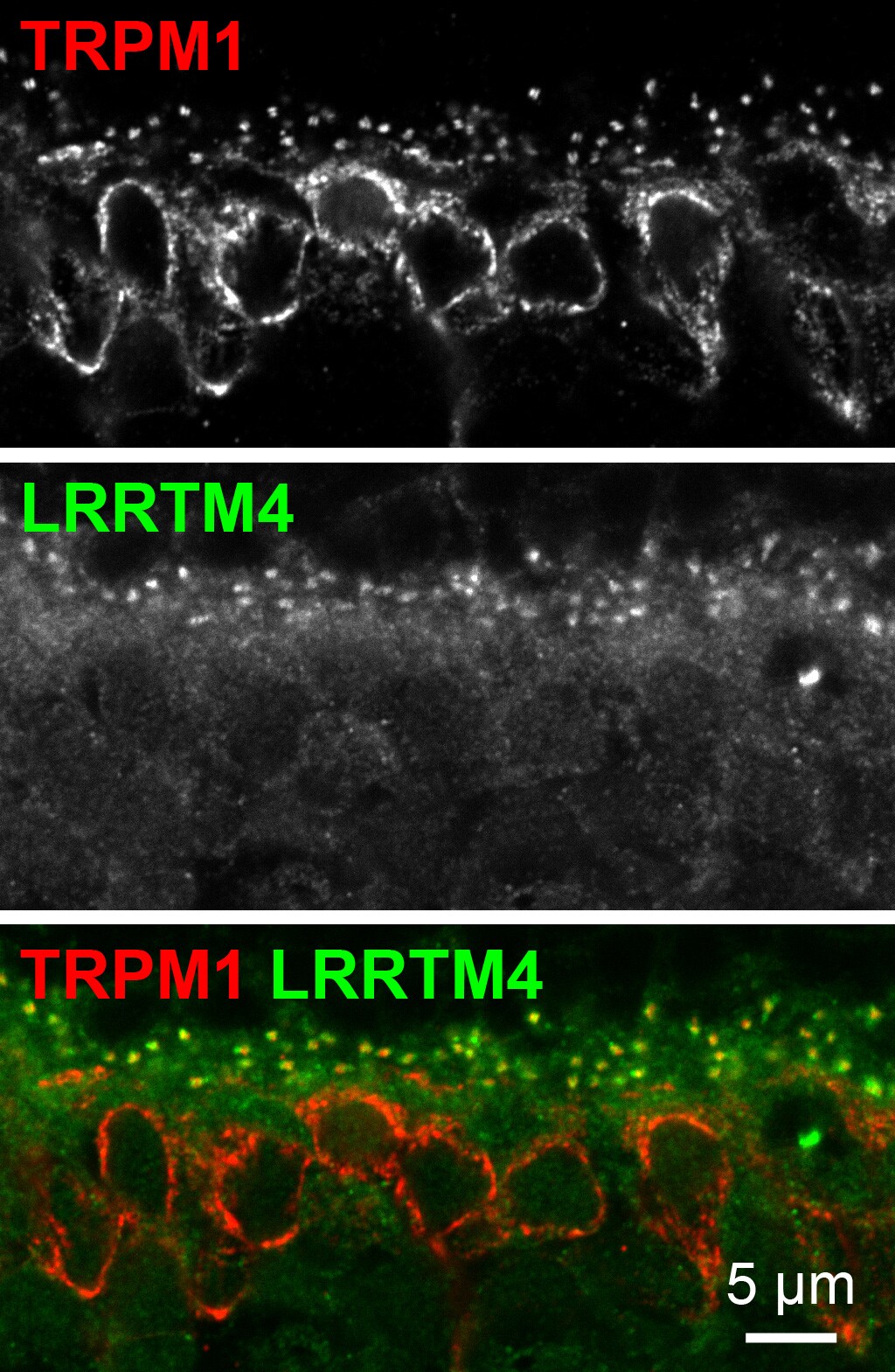 Human LRRTM4 Antibody AF5377