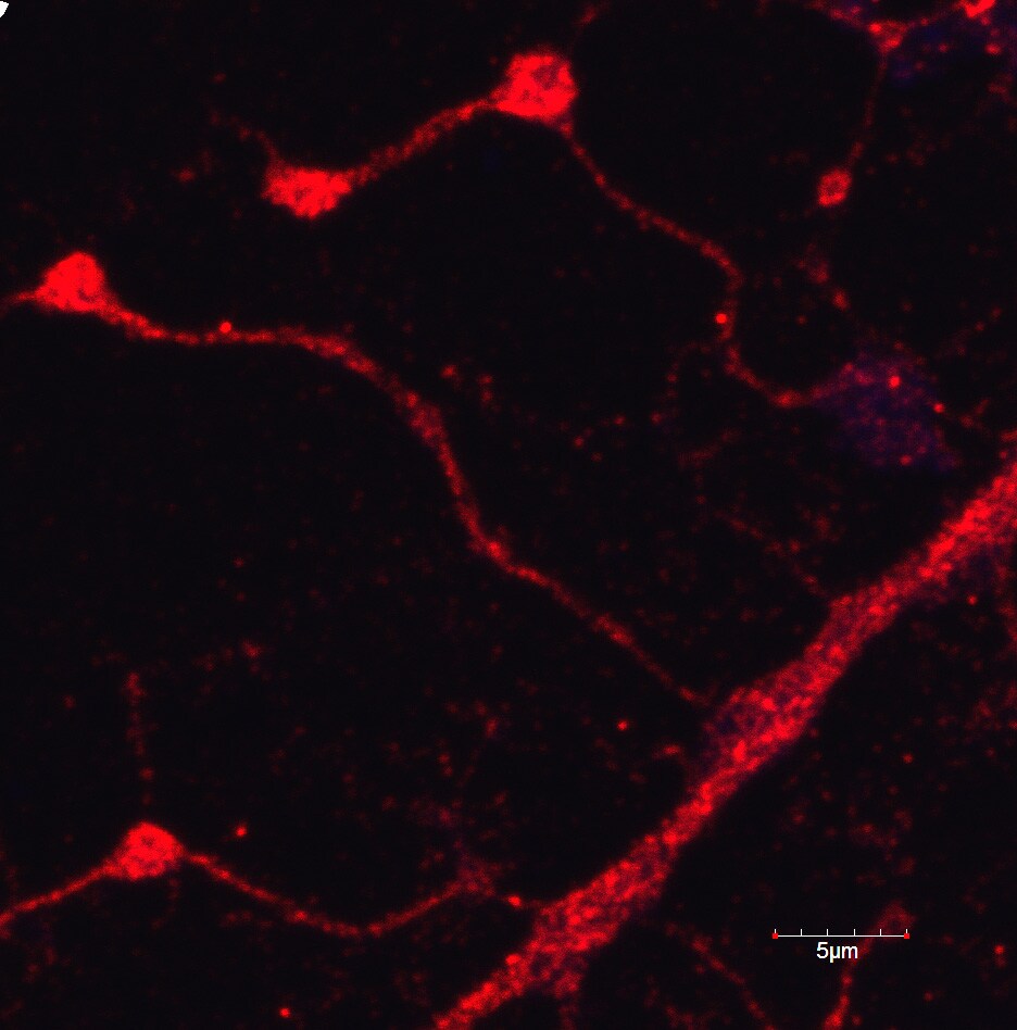 Rat CX3CL1/Fractalkine Chemokine Domain Antibody AF537