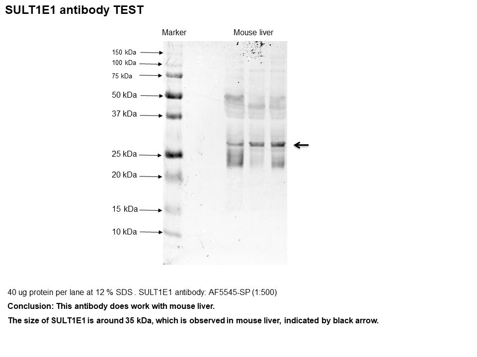 Human Cytosolic Sulfotransferase 1E1/SULT1E1 Antibody AF5545