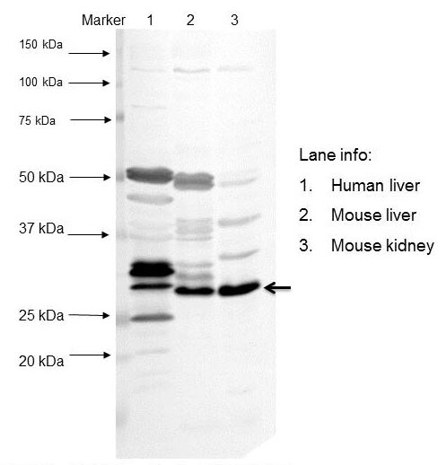 Human Cytosolic Sulfotransferase 1E1/SULT1E1 Antibody AF5545