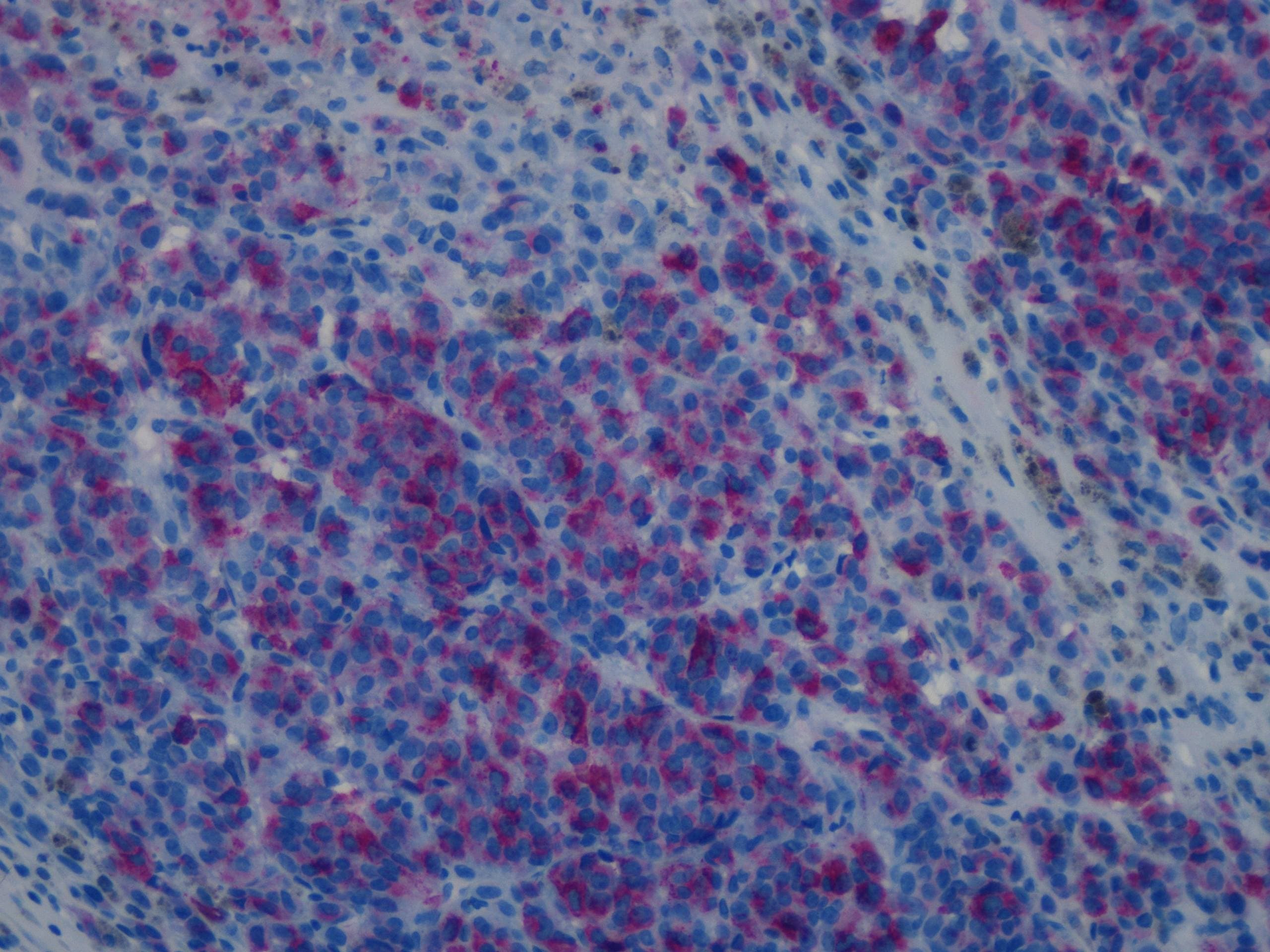 Human/Mouse RASSF2 Antibody AF5639