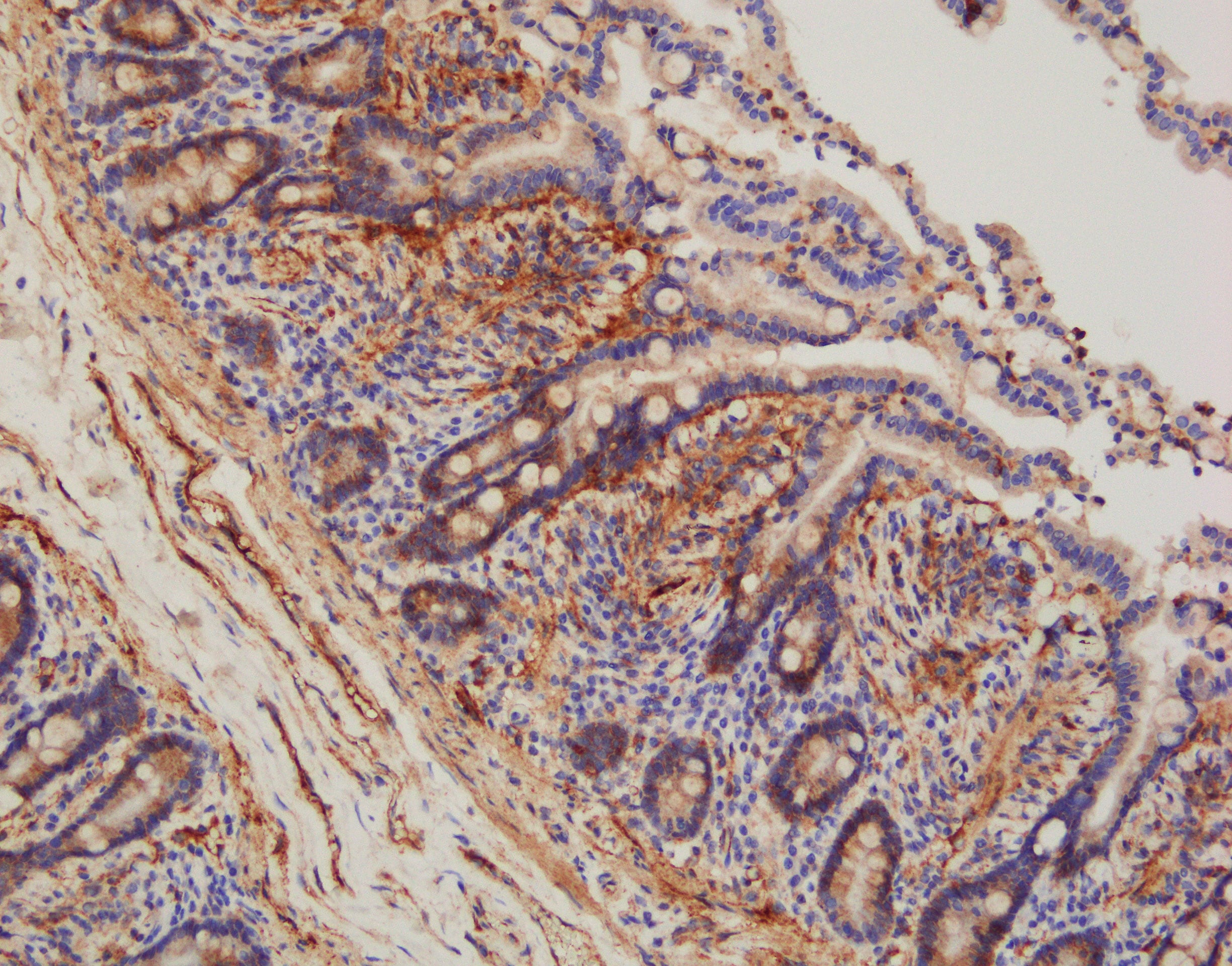 Human Integrin  alpha 1/CD49a Antibody AF5676