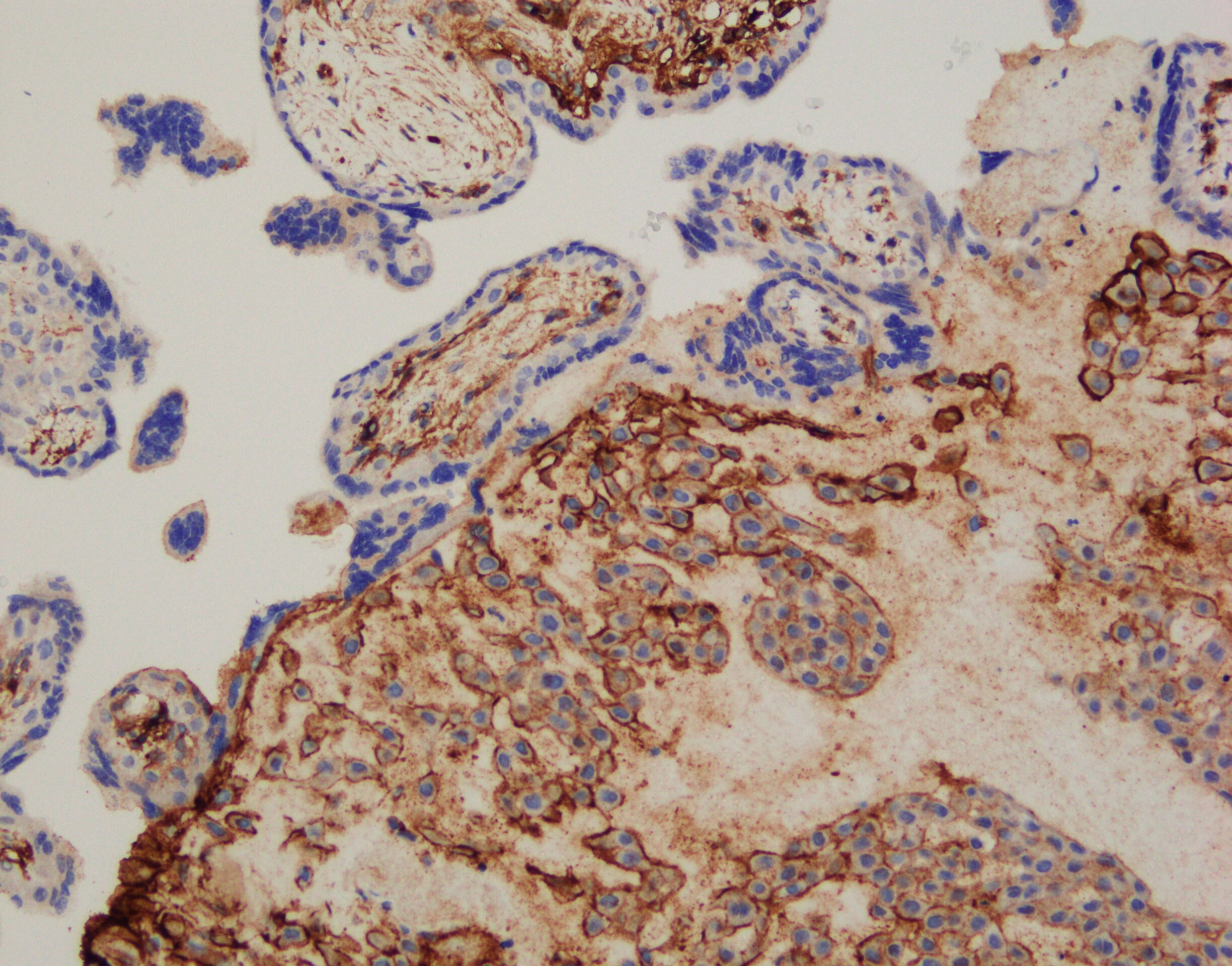 Human Integrin  alpha 1/CD49a Antibody AF5676