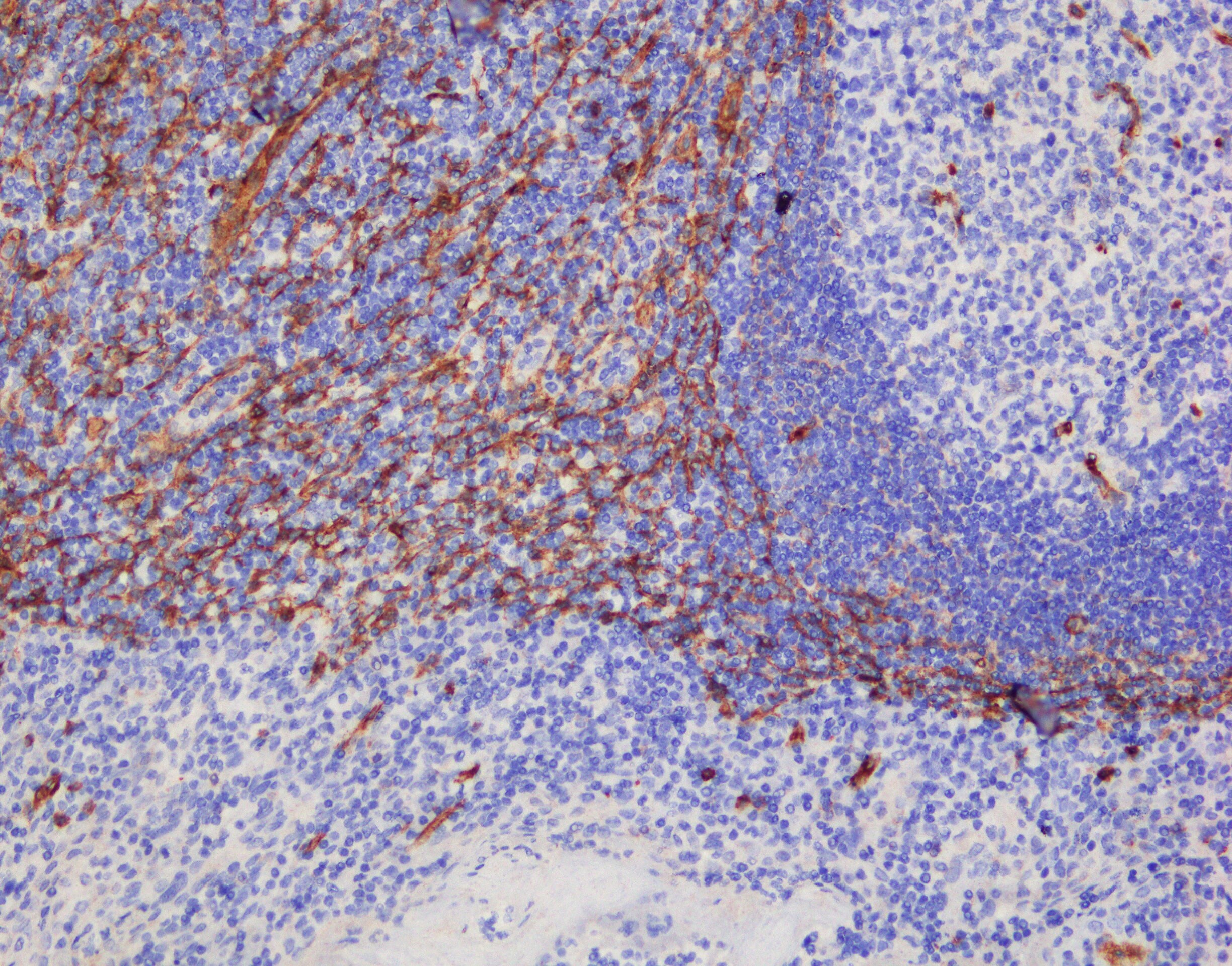 Human Integrin  alpha 1/CD49a Antibody AF5676