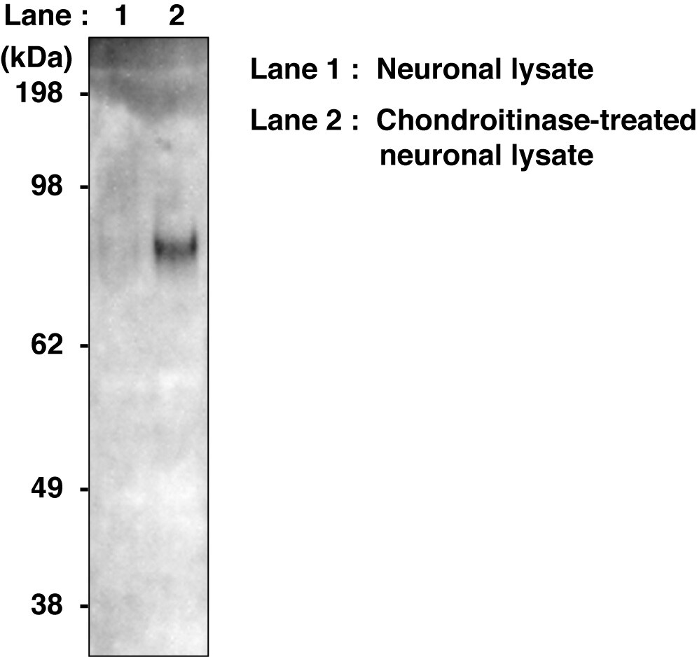 Human Neuroglycan C/CSPG5 Antibody AF5685
