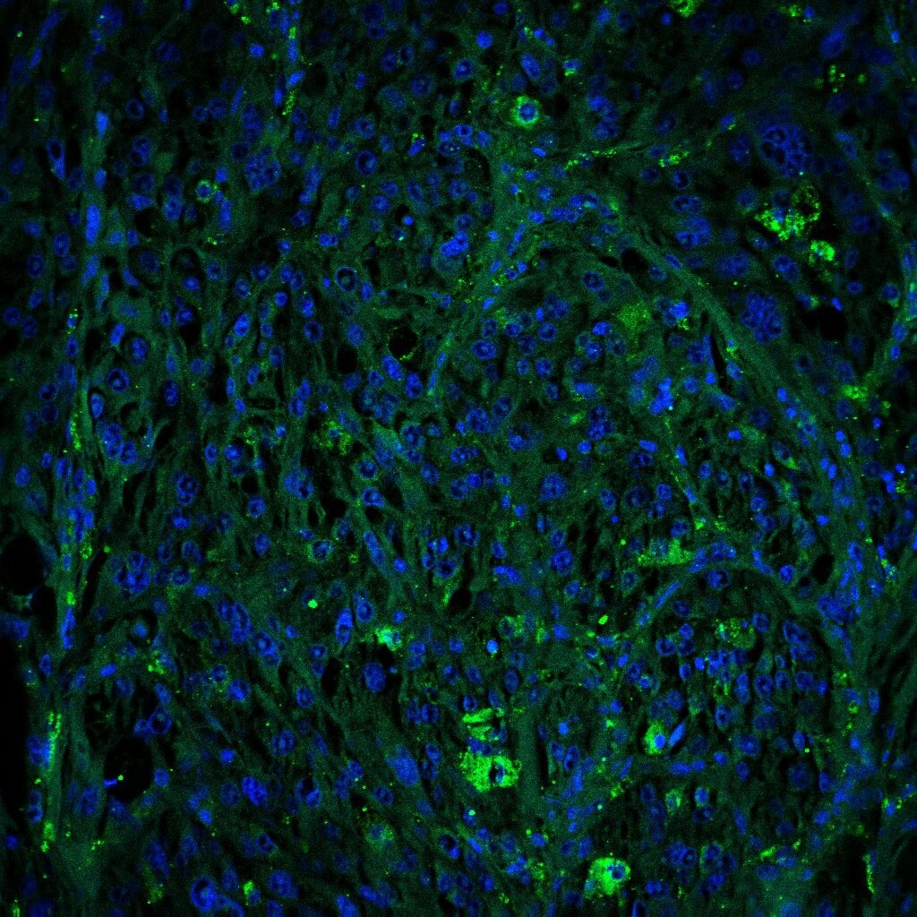 Human FOLR2 Antibody AF5697