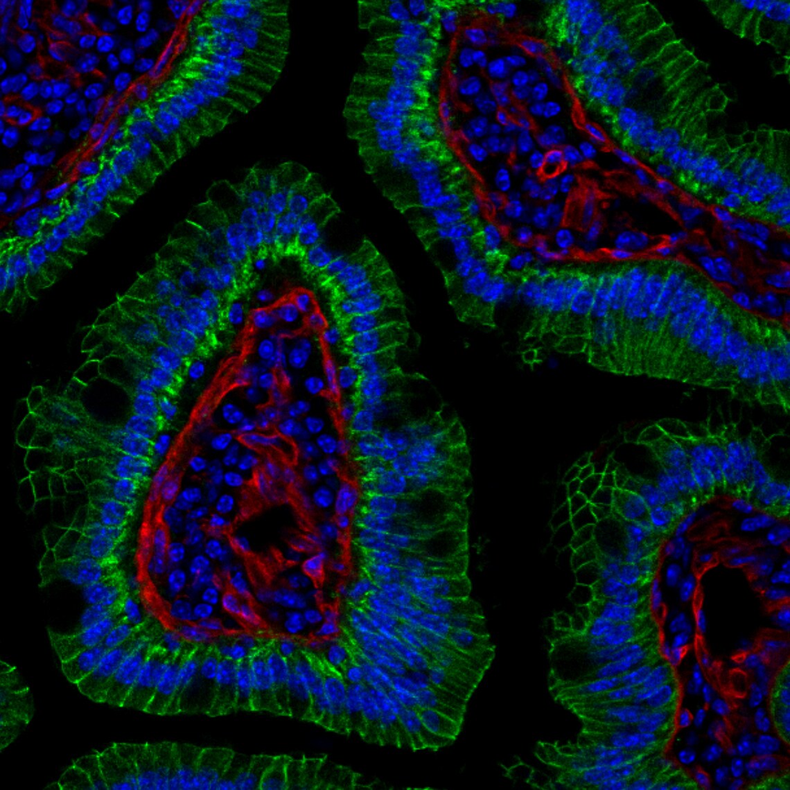 Mouse Endostatin Antibody AF570