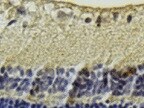 Mouse Endostatin Antibody AF570
