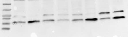 Human p16INK4a / CDKN2A Antibody AF5779