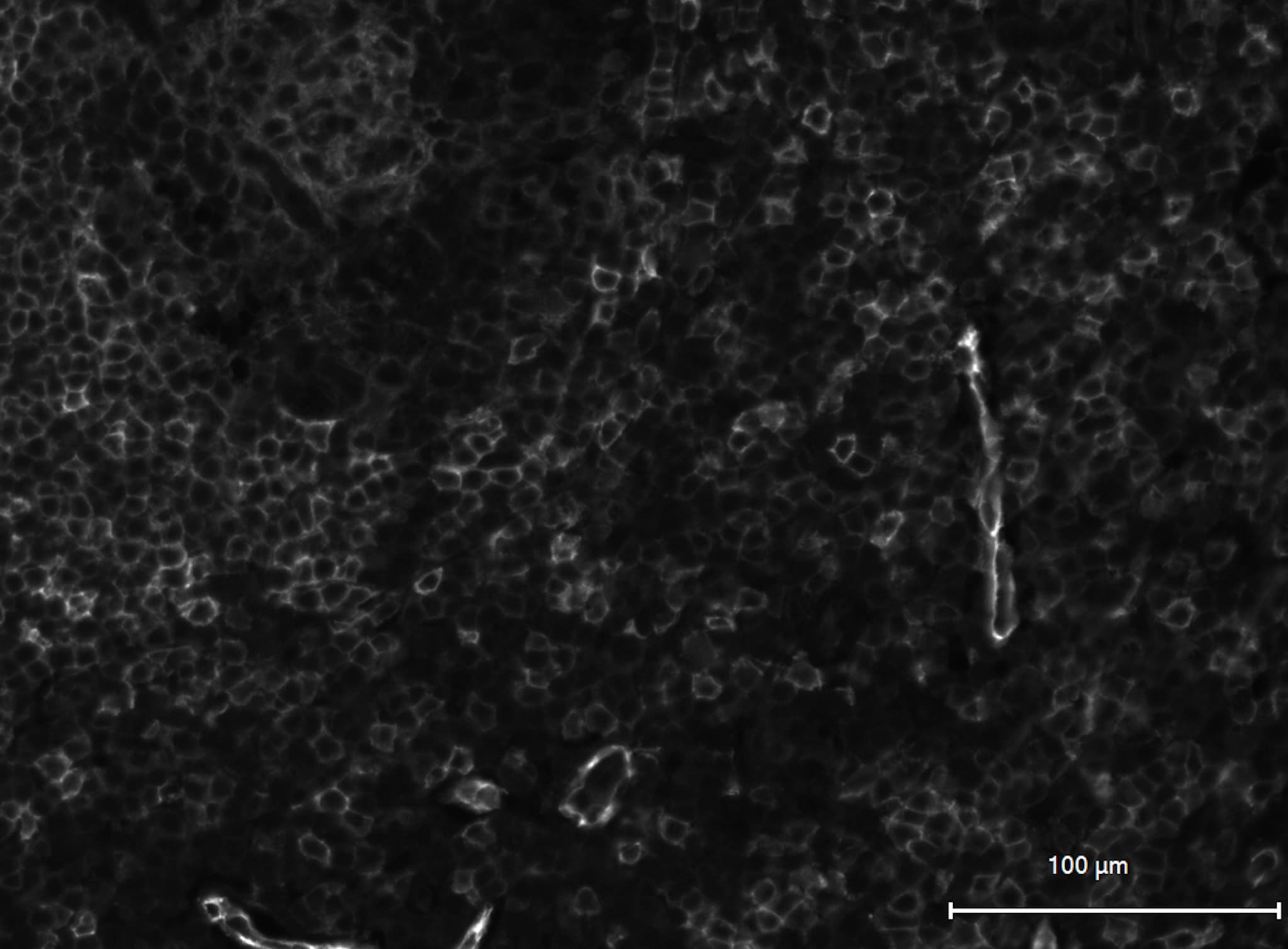 Human 5'‑Nucleotidase/CD73 Antibody AF5795