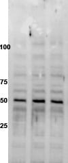 Human/Mouse CX3CR1 Antibody AF5825