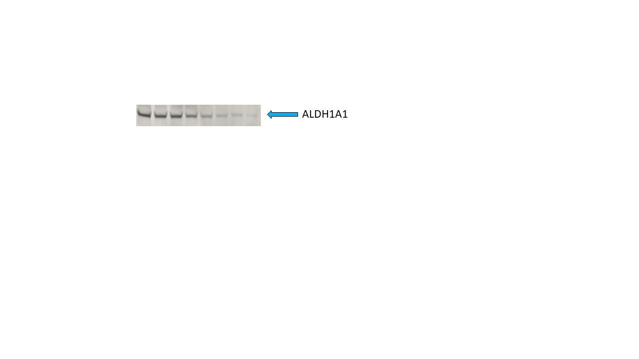 Human/Mouse Aldehyde Dehydrogenase 1‑A1/ ALDH1A1 Antibody AF5869