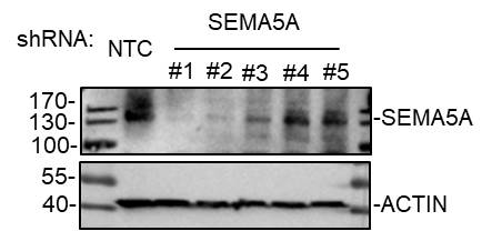Human/Mouse/Rat Semaphorin 5A Antibody AF5896