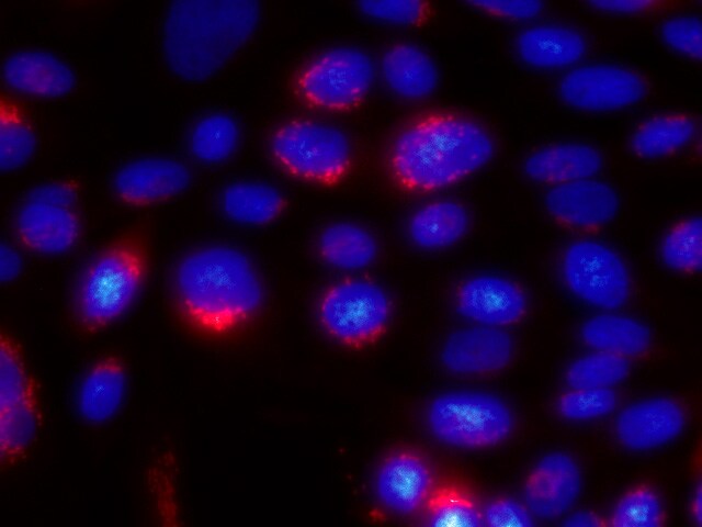 Human ST6 Gal Sialyltransferase 1/ST6GAL1 Antibody AF5924