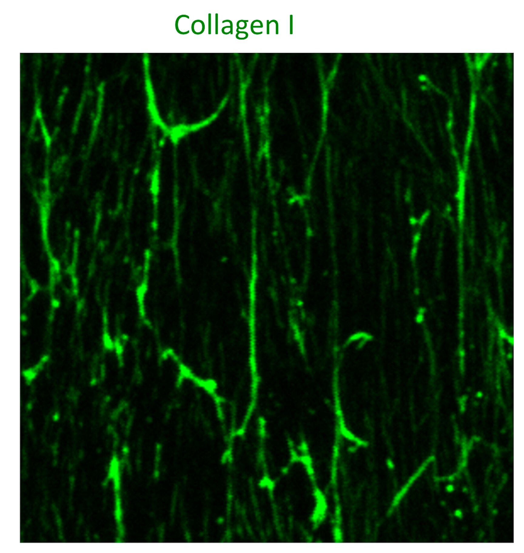Human Pro Collagen I  alpha 1 Antibody AF6220