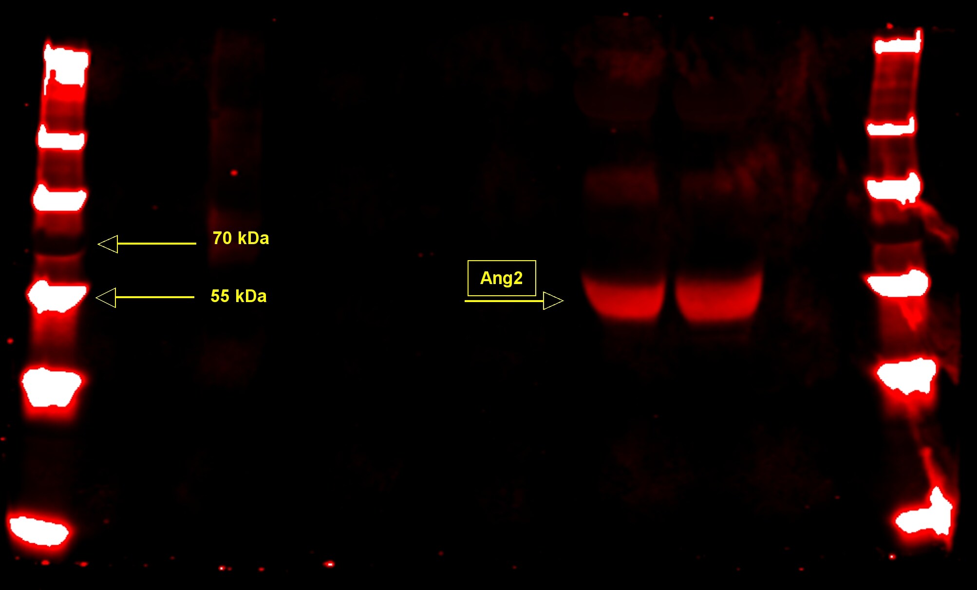 Human Angiopoietin‑2 Antibody AF623