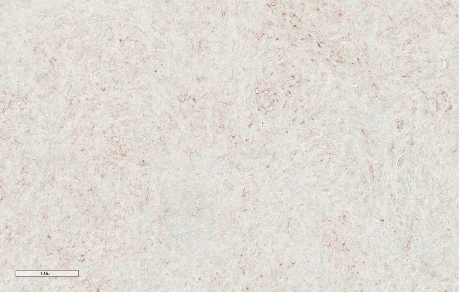 Mouse VCAM‑1/CD106 Antibody AF643