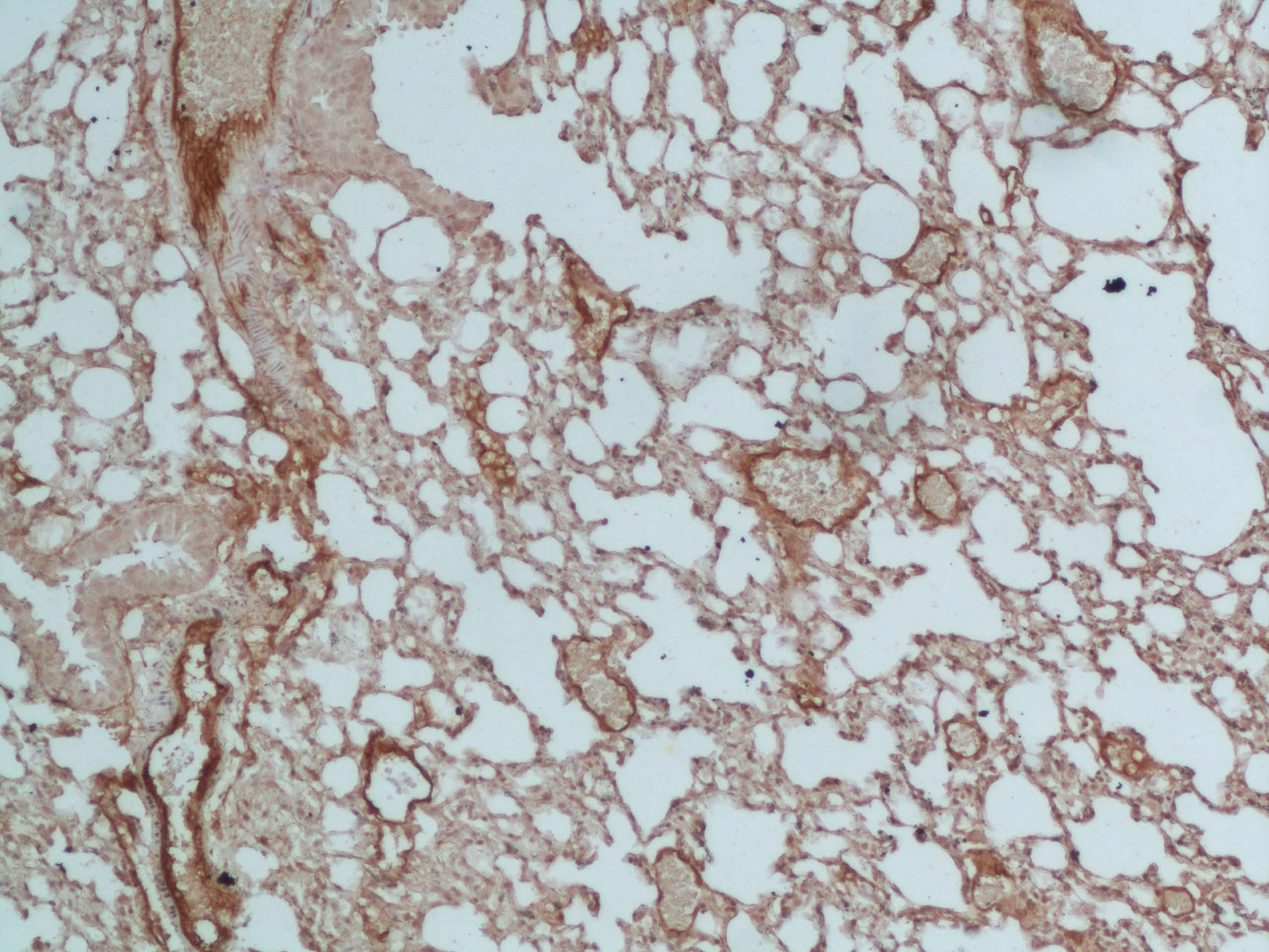 Mouse VCAM‑1/CD106 Antibody AF643