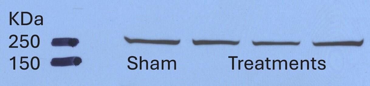 Mouse VEGFR2/KDR/Flk-1 Antibody AF644