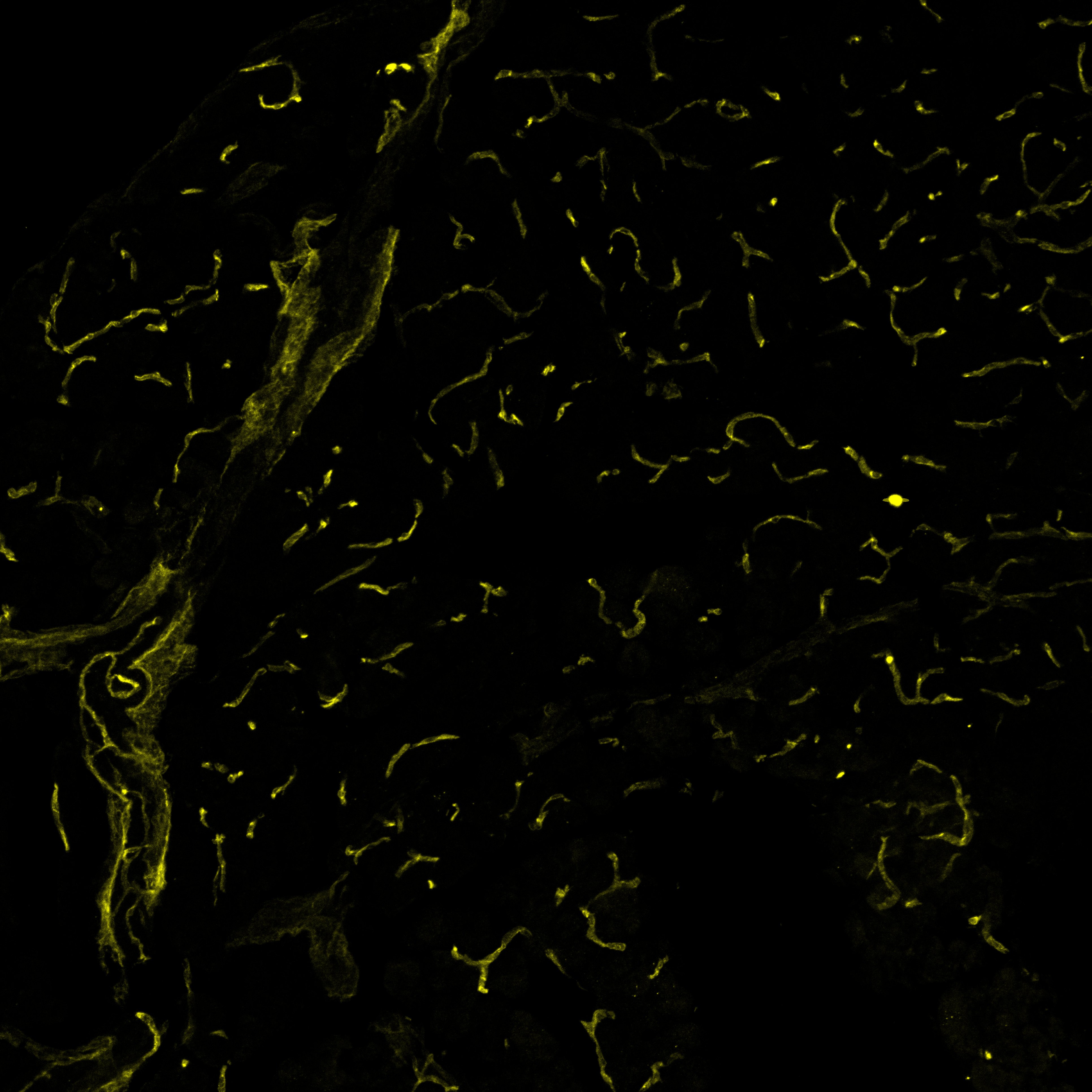 Mouse VEGFR2/KDR/Flk-1 Antibody AF644