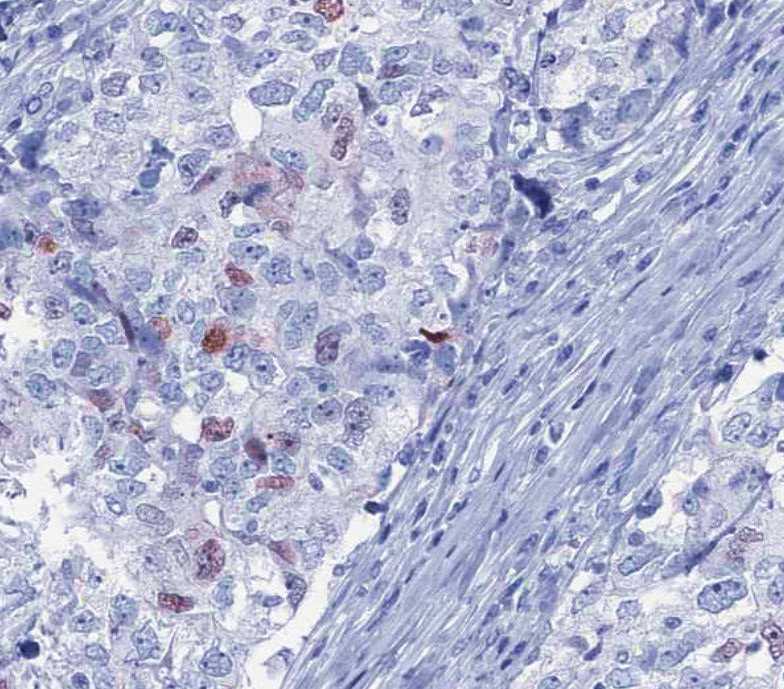 Human ASCL2/Mash2 Antibody AF6539