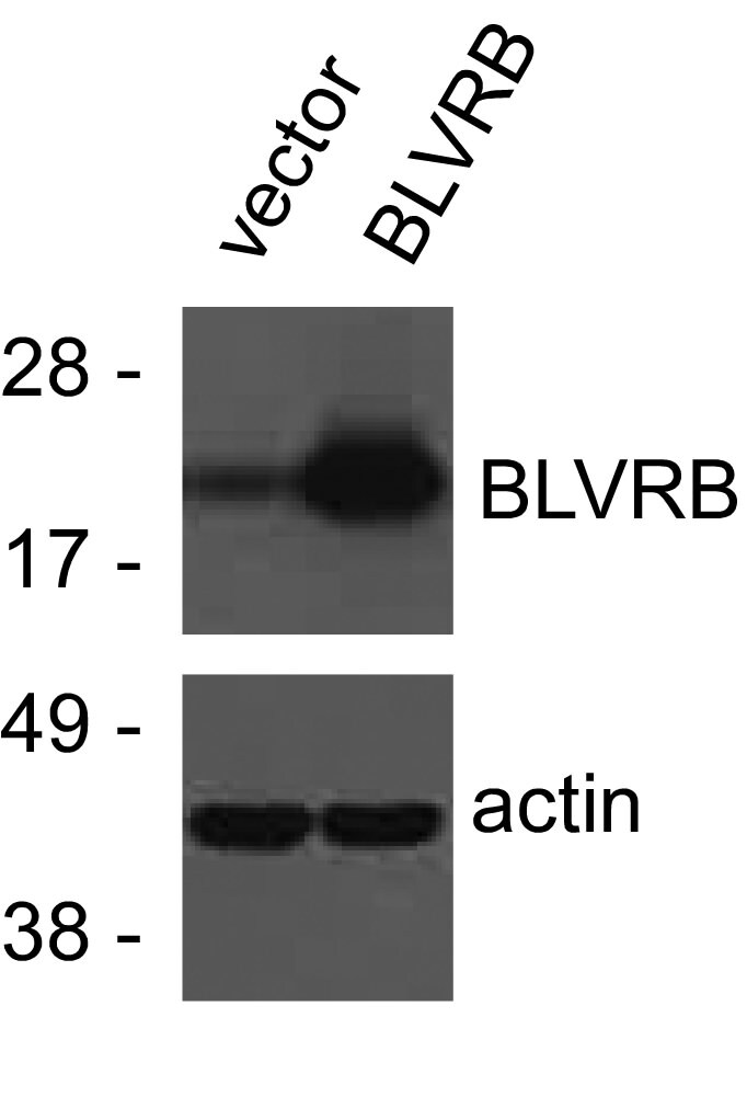 Human/Mouse/Rat Biliverdin Reductase B/BLVRB Antibody AF6568