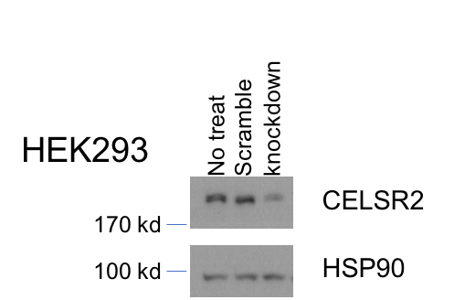 Human/Mouse CELSR2 Antibody AF6739