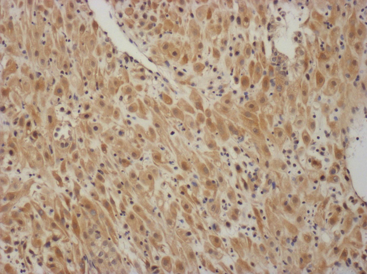 Human MMP-19 Antibody AF6790
