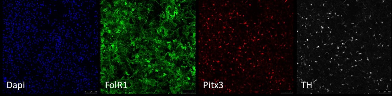 Mouse FOLR1 Antibody AF6936