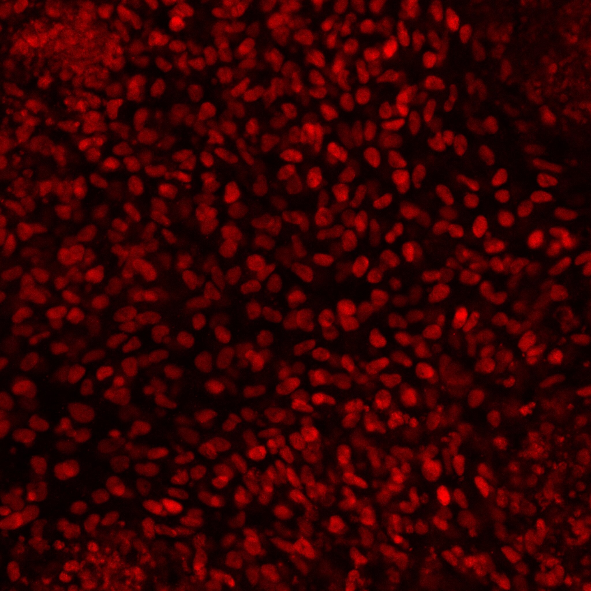 Human/Mouse EBF‑2 Antibody AF7006
