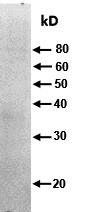 Human/Mouse/Rat Rab27a Antibody AF7245