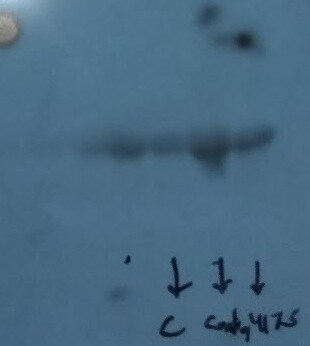 Human E‑Selectin/CD62E Antibody AF724