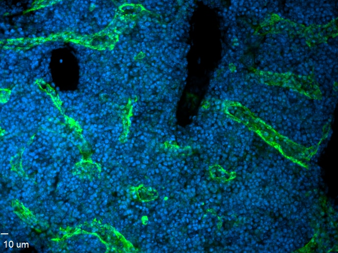 Mouse VEGFR3/Flt-4 Antibody AF743