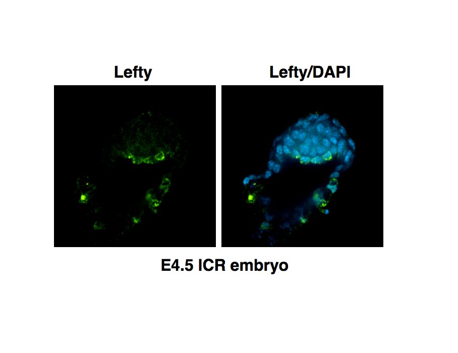 Human/Mouse Lefty Antibody AF746