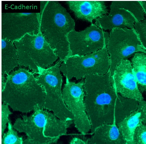 Human/Mouse E‑Cadherin Antibody AF748