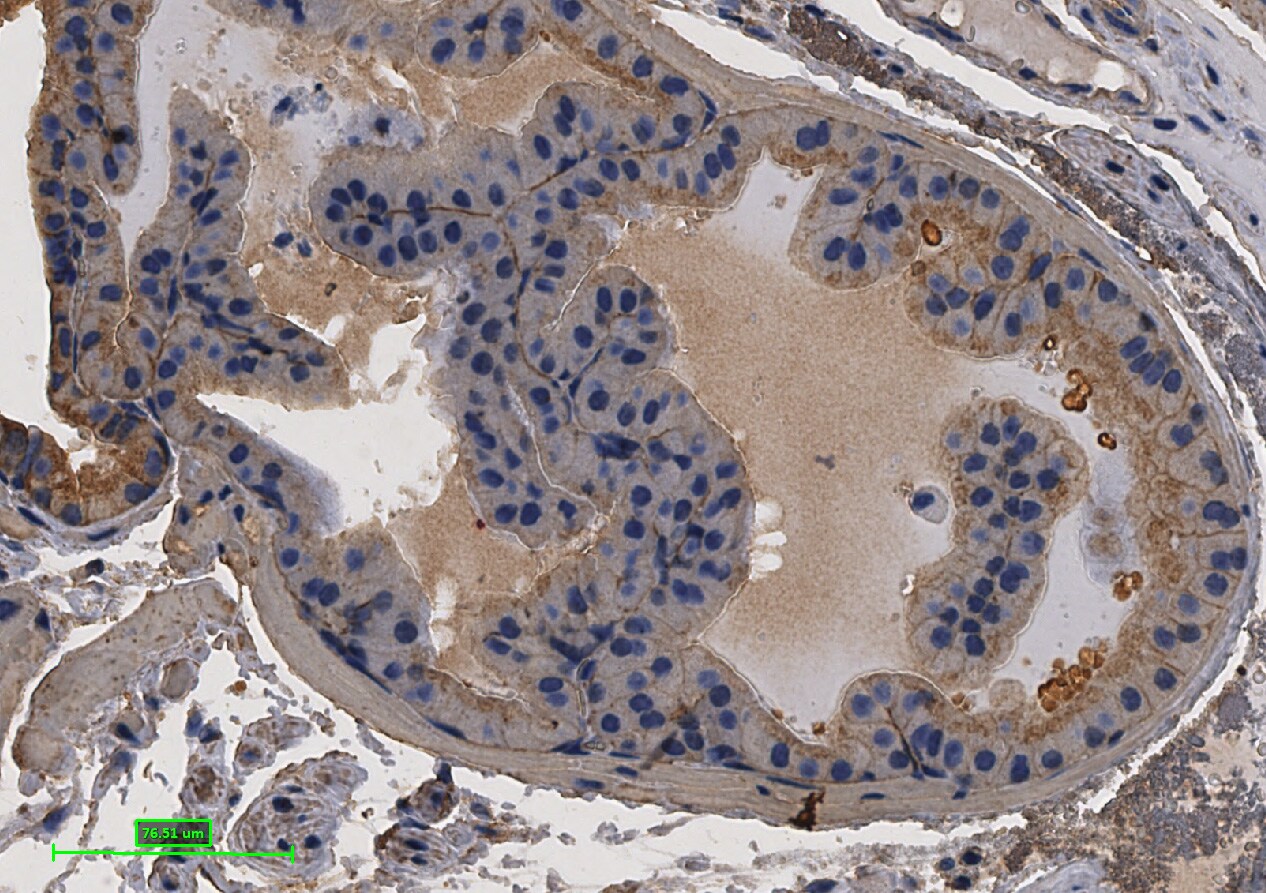 Human/Mouse E‑Cadherin Antibody AF748