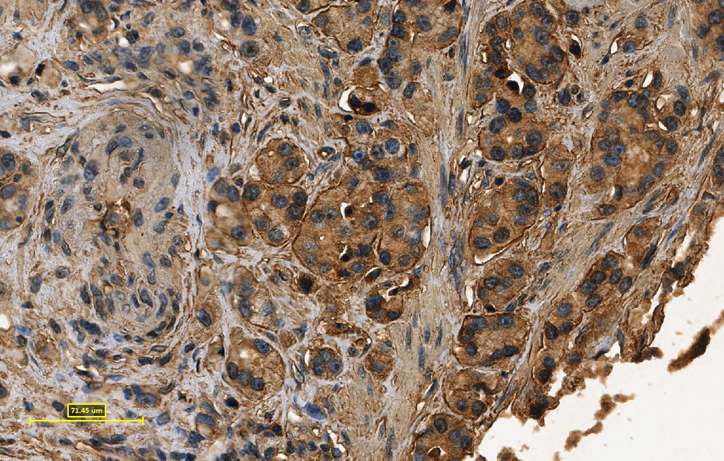Human/Mouse E‑Cadherin Antibody AF748