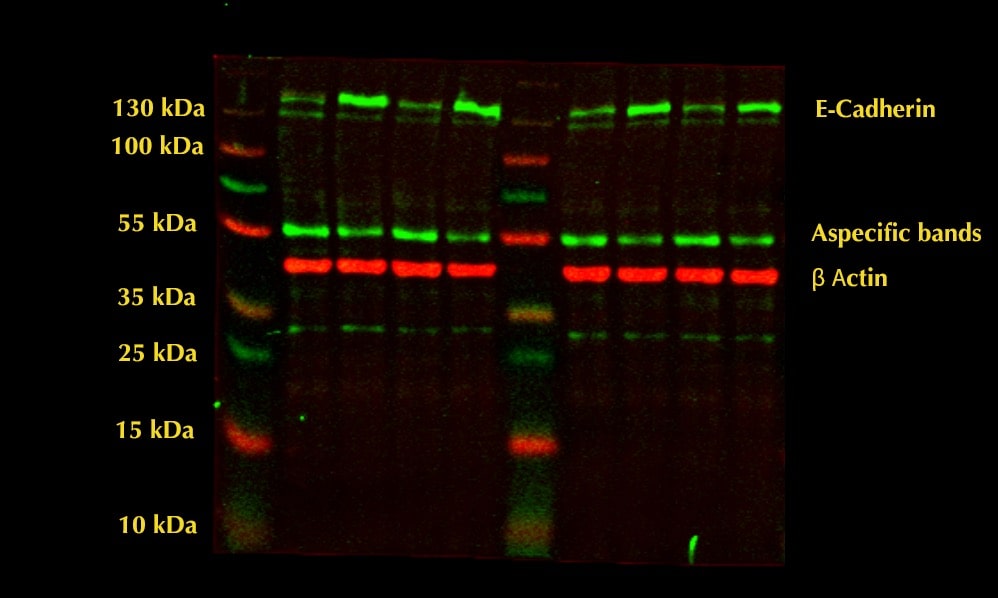 Human/Mouse E‑Cadherin Antibody AF748
