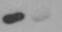 Human Polypeptide GalNac Transferase 2/GALNT2 Antibody AF7507