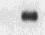 Human Polypeptide GalNac Transferase 2/GALNT2 Antibody AF7507
