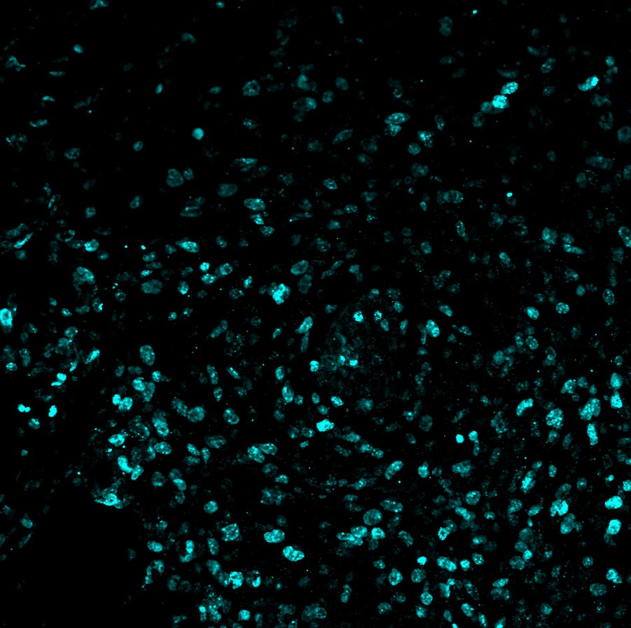 Human Ki67/MKI67 Antibody AF7617