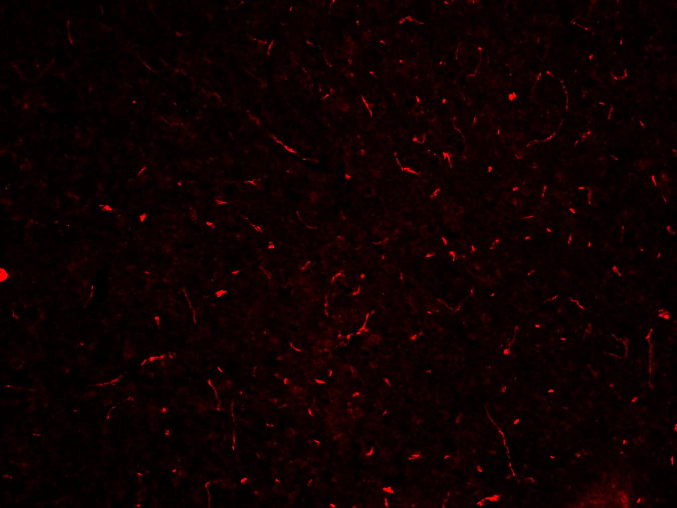 Mouse/Rat Tie‑2 Antibody AF762