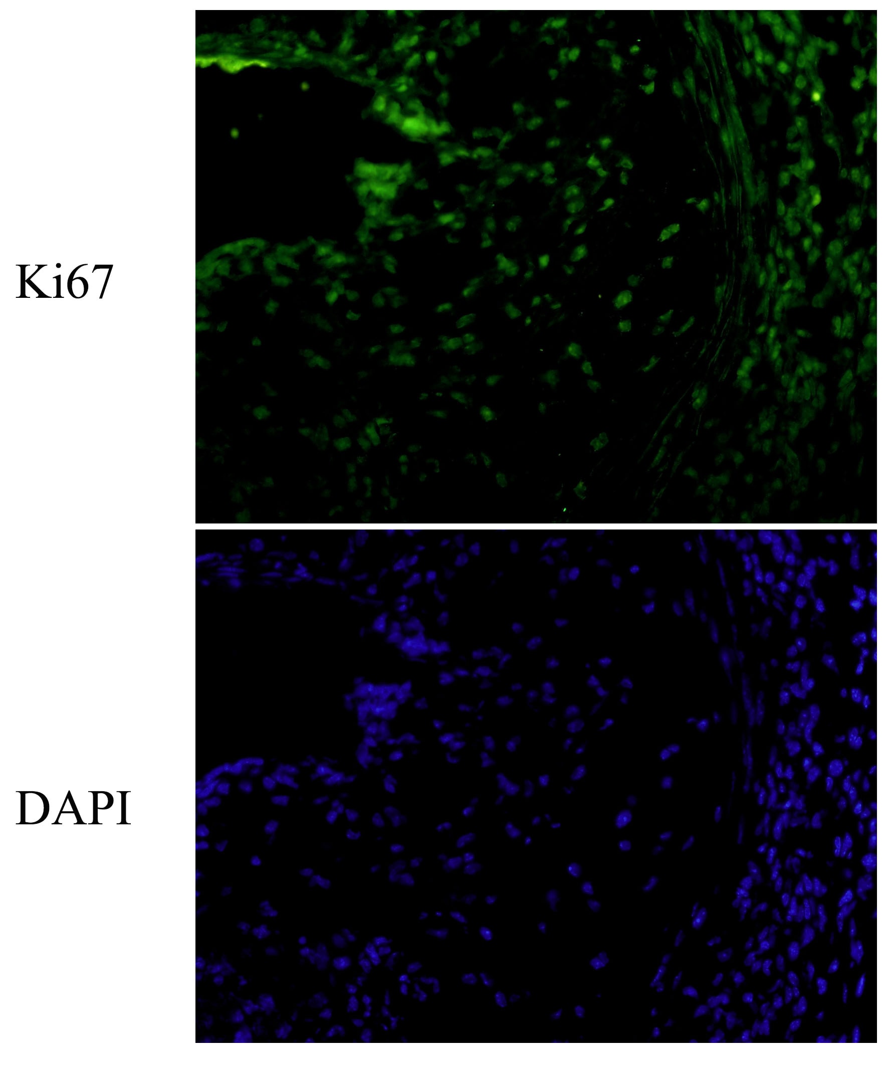 Mouse Ki67/MKI67 Antibody AF7649