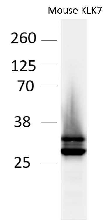 Mouse/Rat Kallikrein 7 Antibody AF7688
