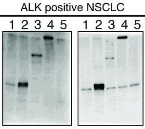 Mouse ALK‑1 Antibody AF770
