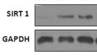 Human Sirtuin 1/SIRT1 Antibody AF7714