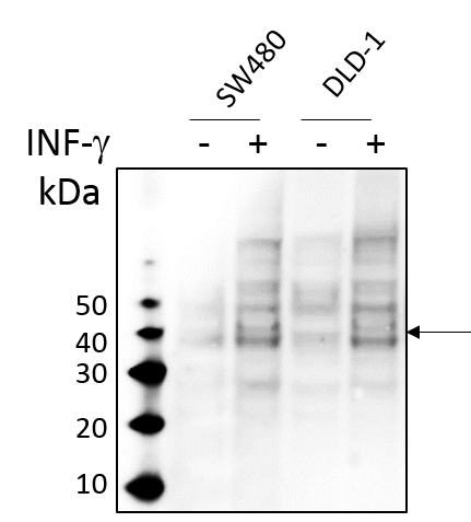 Human IFN‑ gamma  R2 Antibody AF773