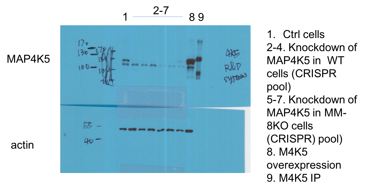 Human MAP4K5 Antibody AF8007